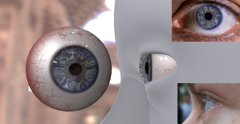 Первый в мире протез глаза, напечатанный на 3D-принтере, установлен пациенту